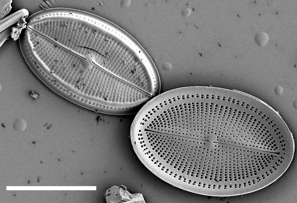 Cocconeis Placentula  Sem1