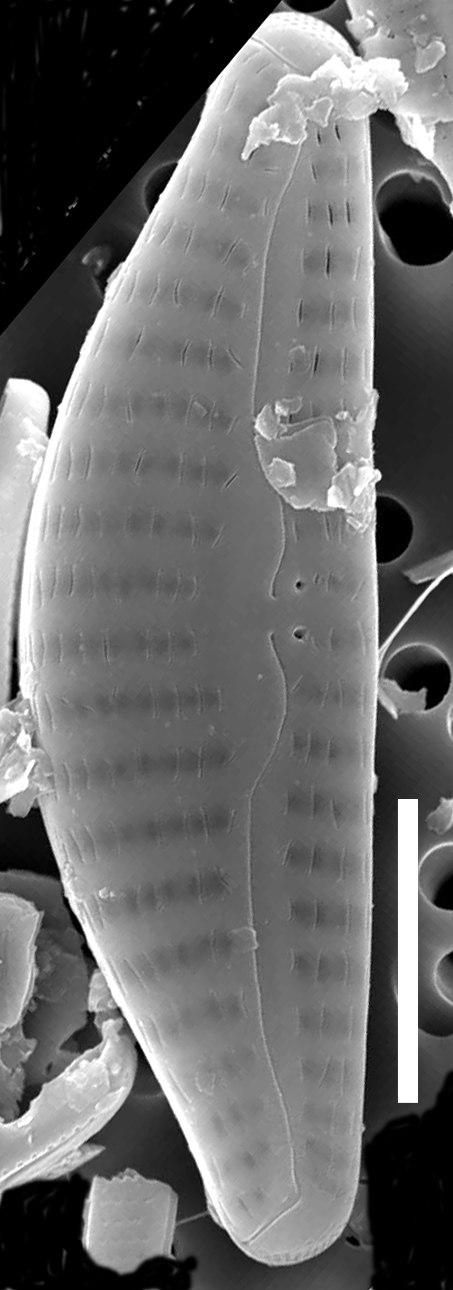 Cymbellacosleyi  Sem External Scale5Mu