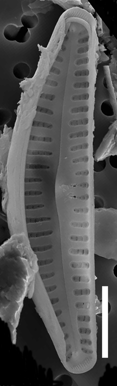 Cymbellacosleyi  Sem Internal Scale5Mu