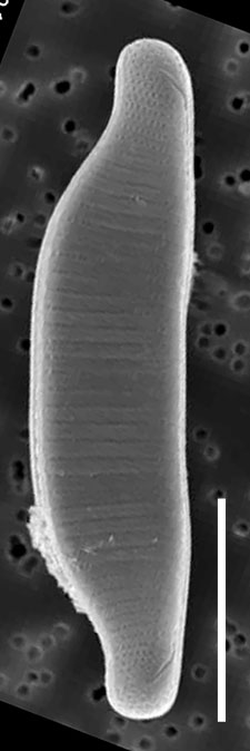 Eunotia Sudetica  Sem Externalwholevalve