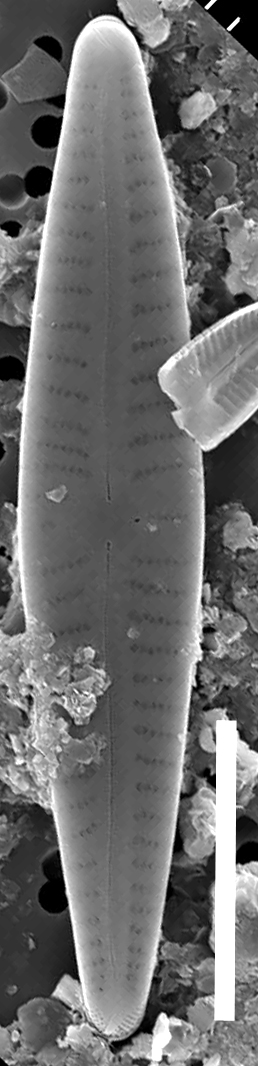 Gomphjohnsonii  Sem Wholevalve 10Mu