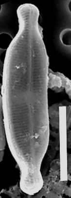 Nupelatenuicephala  Sem Externalwholevalve 494201 5Microns