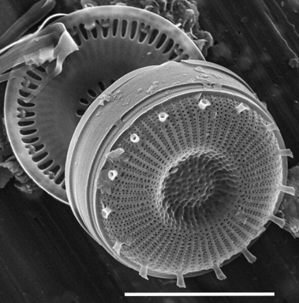 Discostella asterocostata SEM9