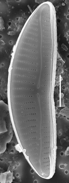 Encyonema procerum  Sem Wholevalve External