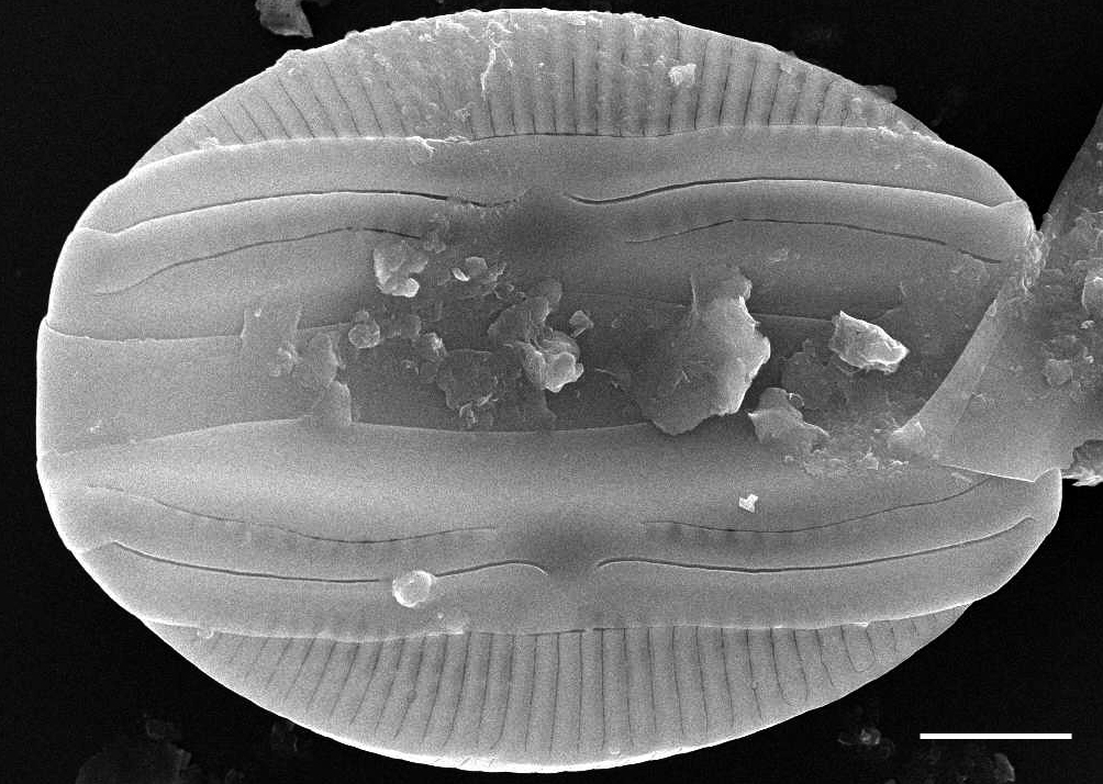 Amphora ovalis SEM1