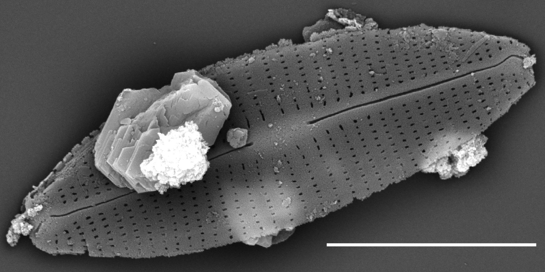  Craticula molestiformis SEM1