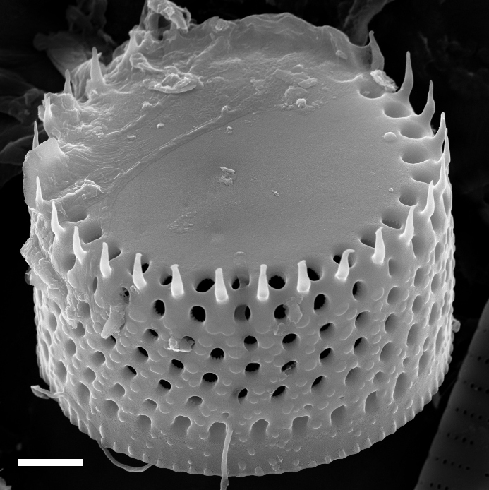 Aulacoseira alpigena SEM1