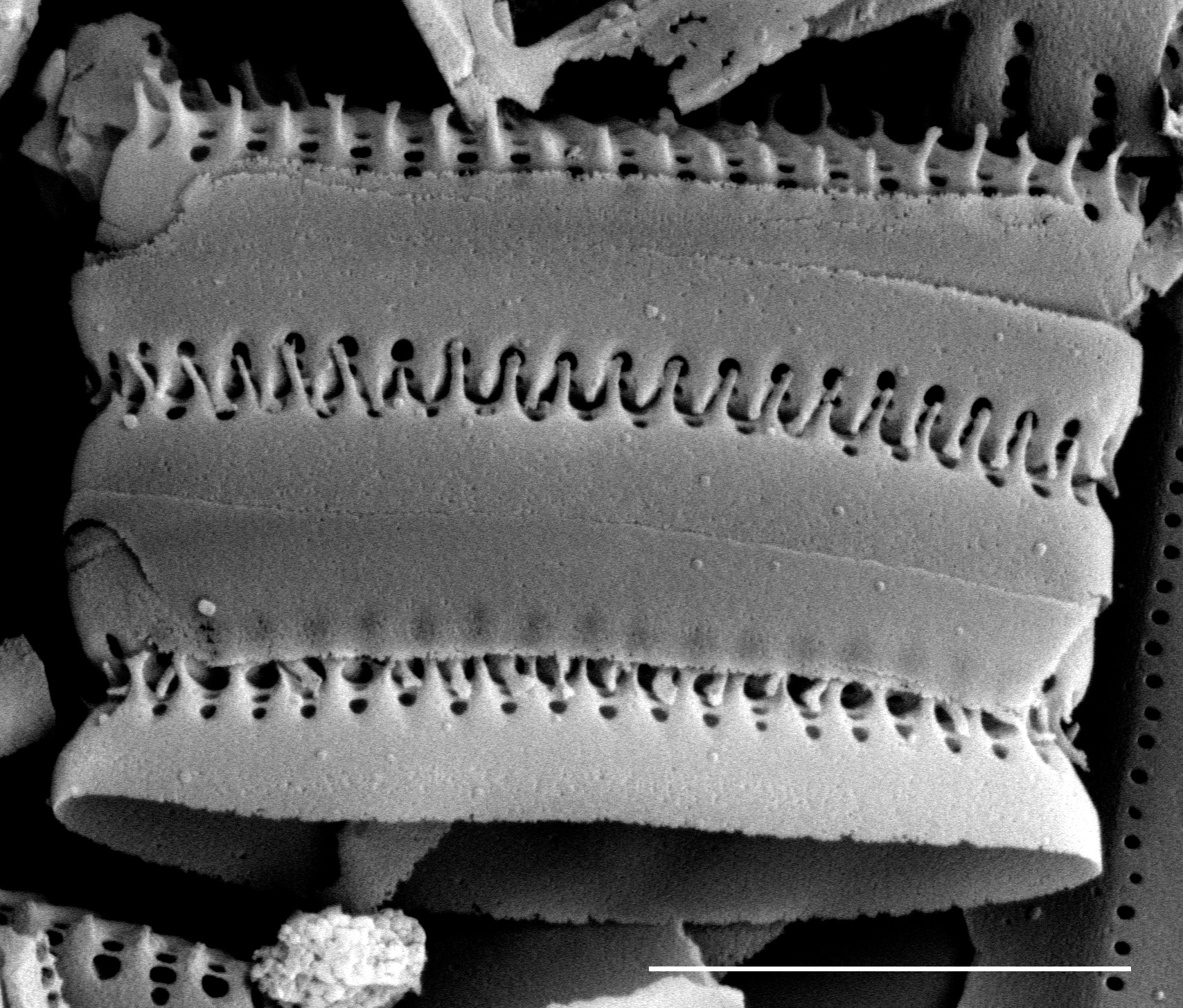 Stauroforma exiguiformis SEM1