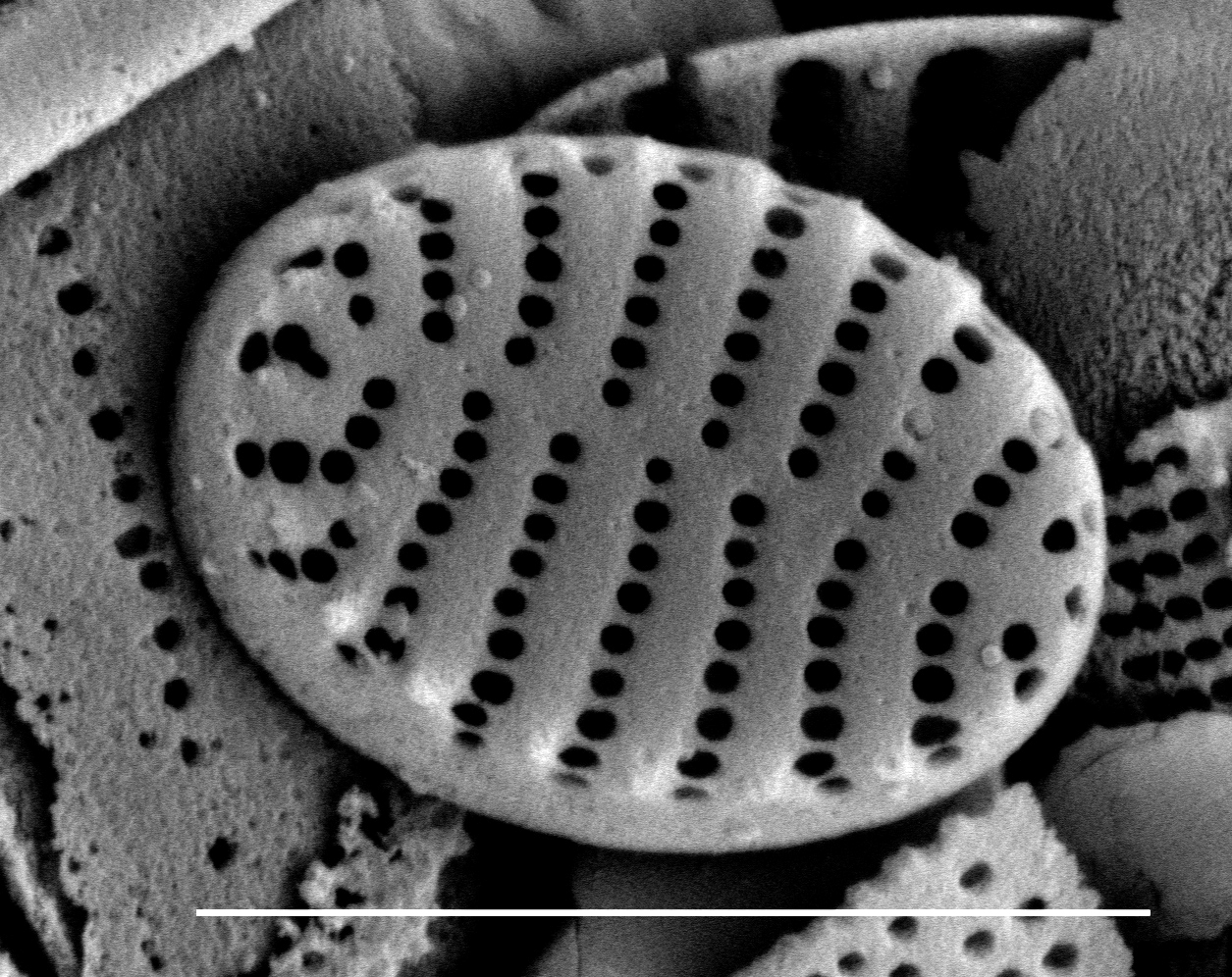 Stauroforma exiguiformis SEM2