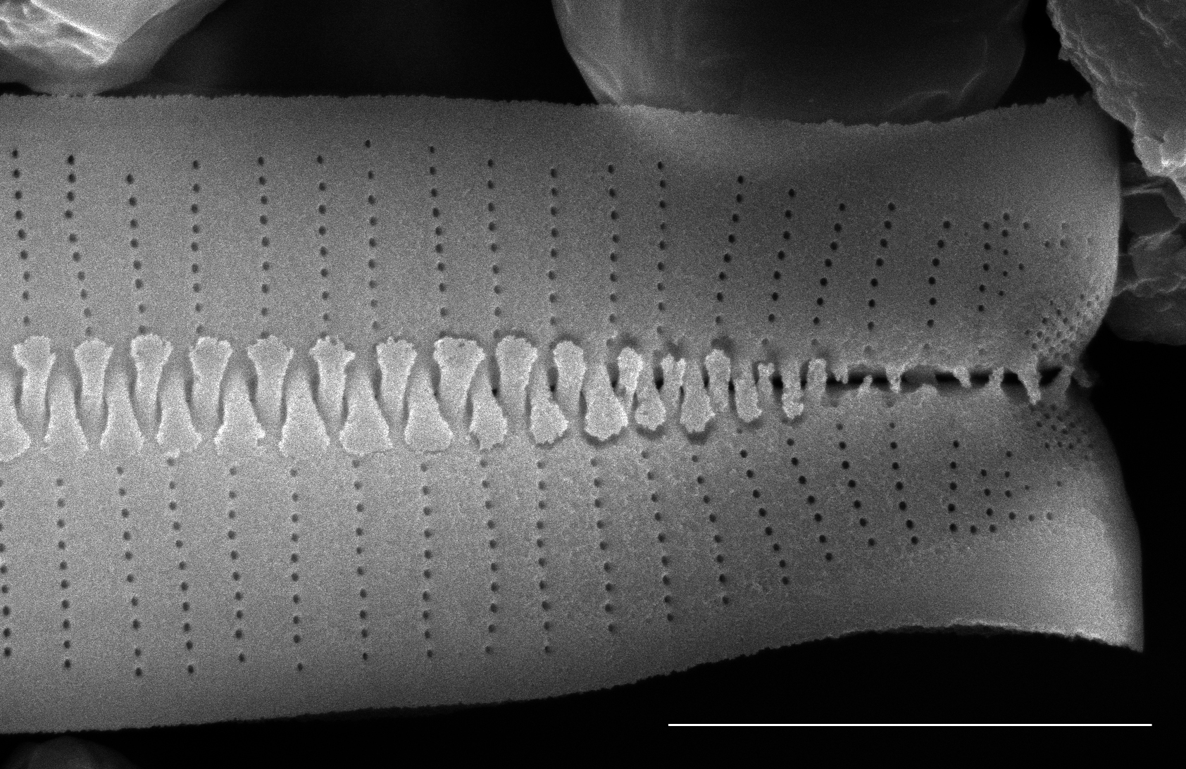 Fragilariforma virescens SEM1