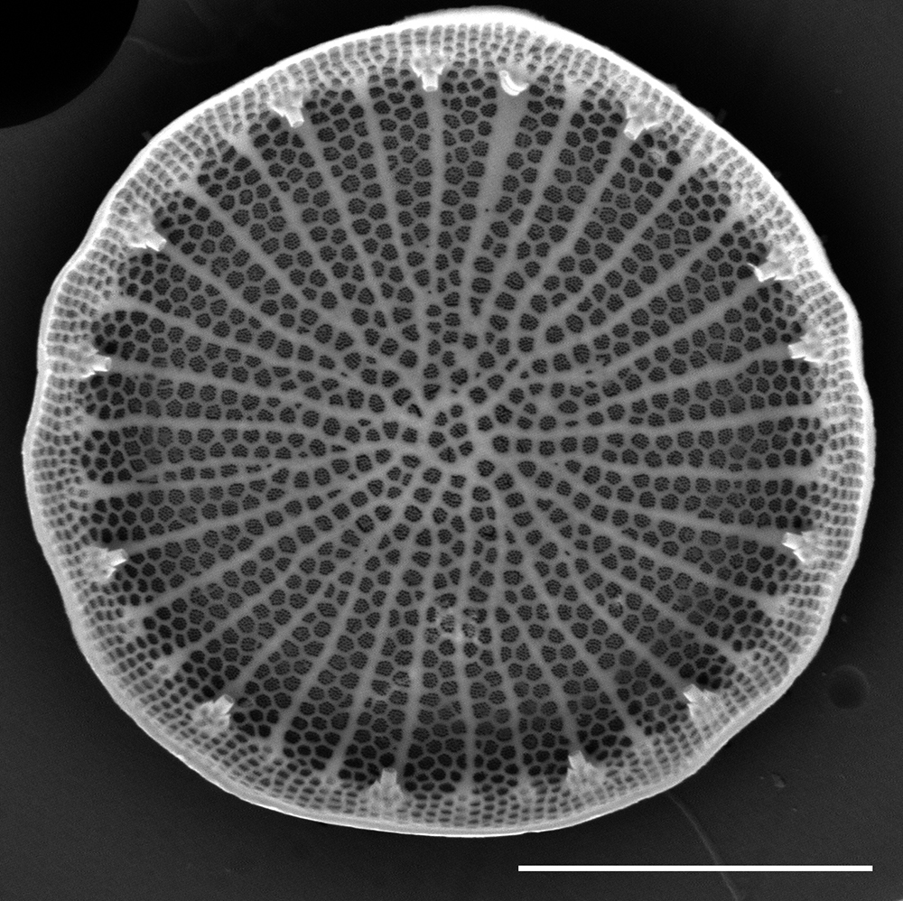 Stephanodiscus hantzschii f tenuis SEM1