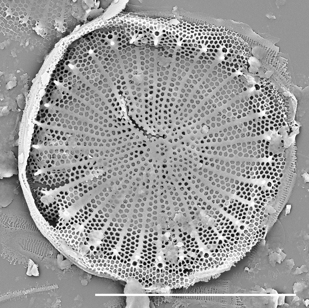 Stephanodiscus hantzschii f tenuis SEM2