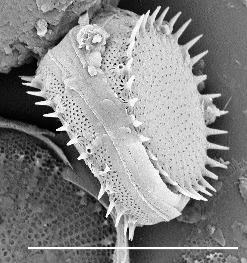 Stephanodiscus hantzschii SEM1