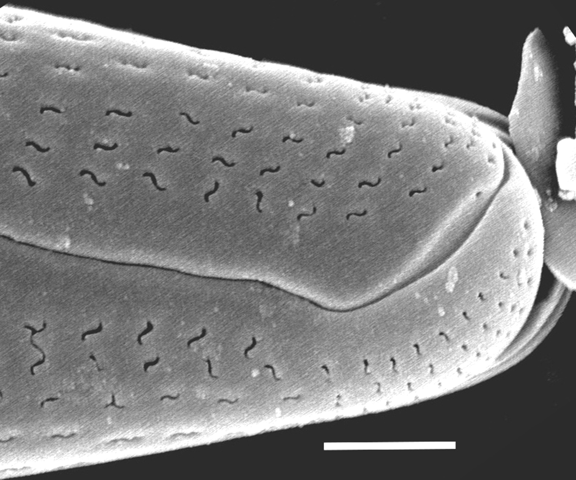 Delicata montana SEM2