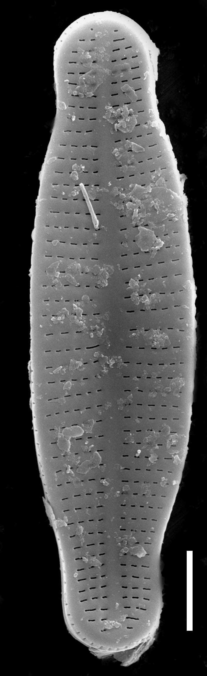 Achnanthidium latecephalum SEM1