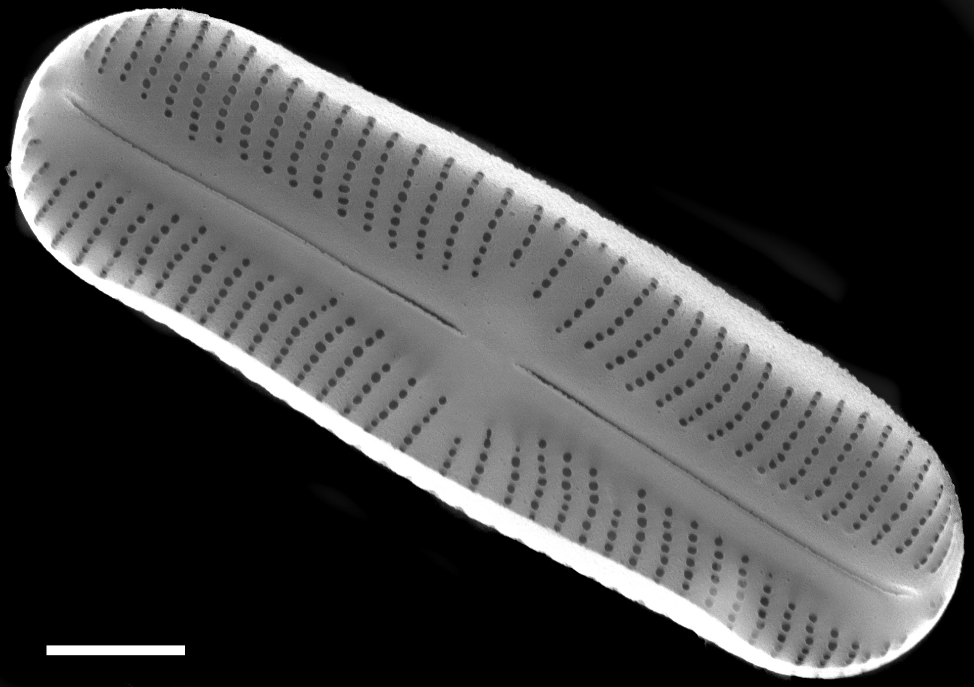 Sellaphora stroemii SEM1