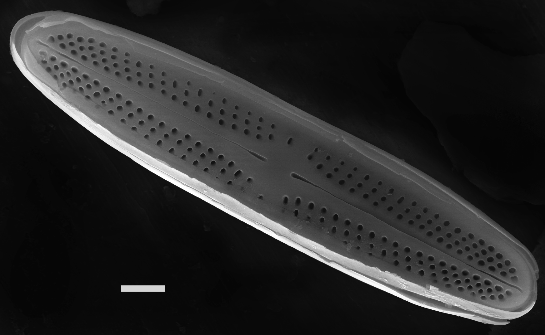 Achnanthidium minutissimum SEM2