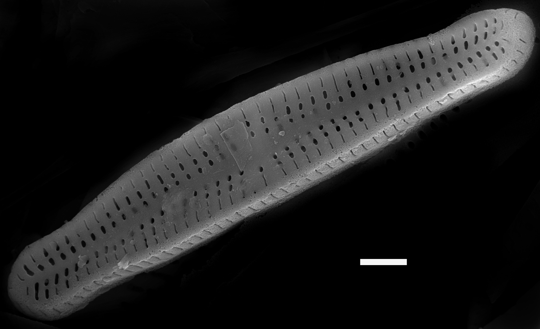 Achnanthidium minutissimum SEM4