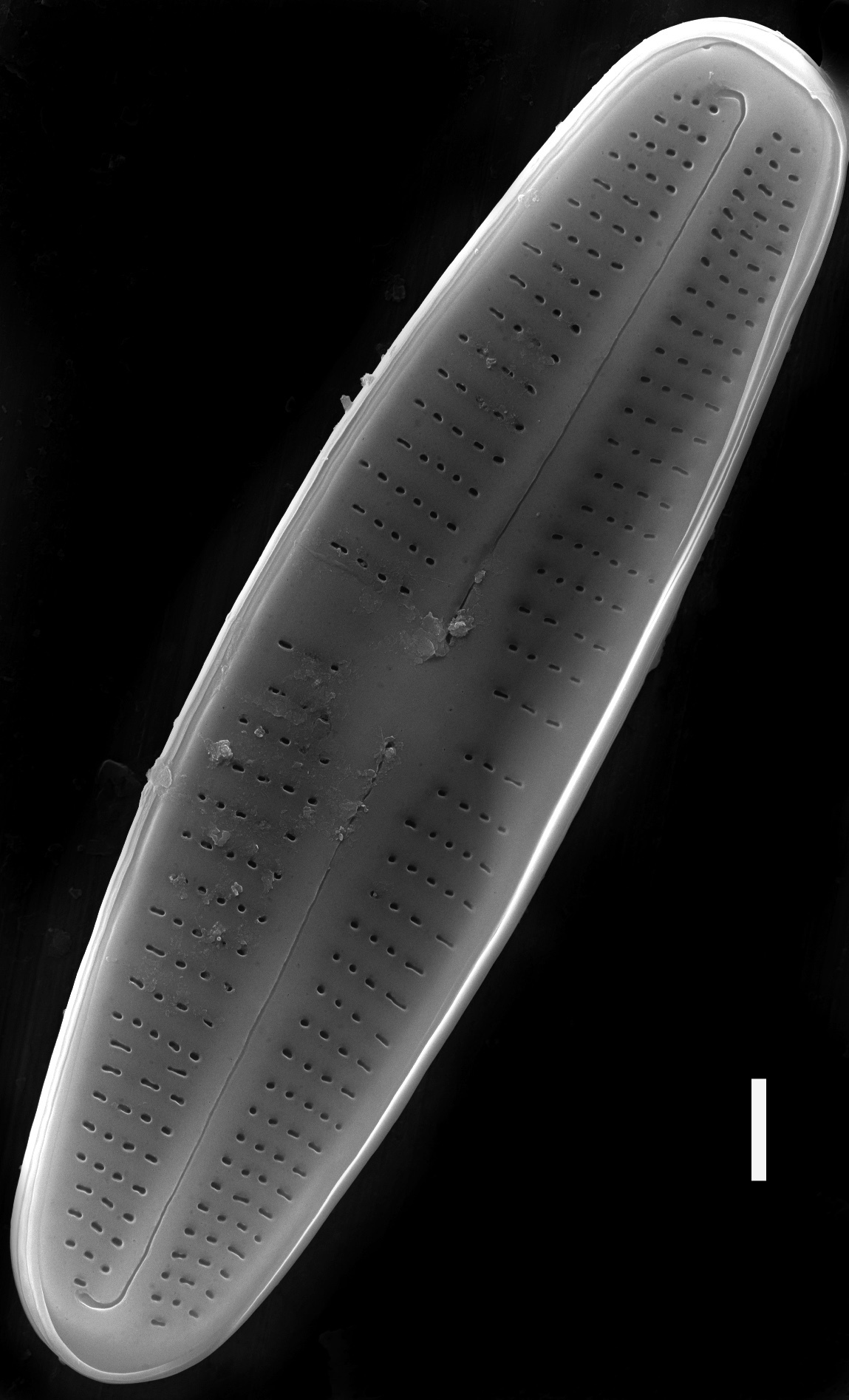 Achnanthidium rivulare SEM2