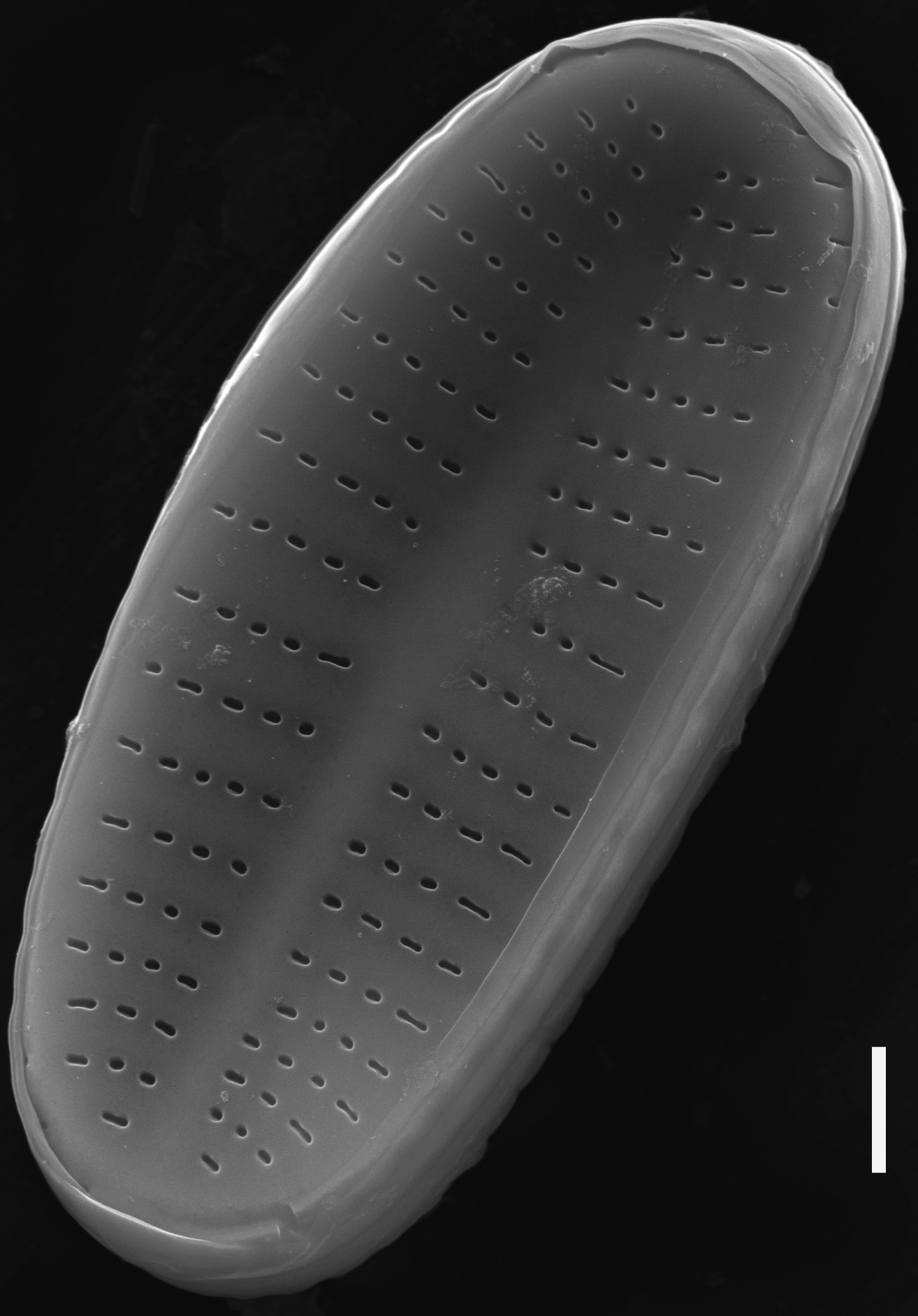 Achnanthidium rivulare SEM3