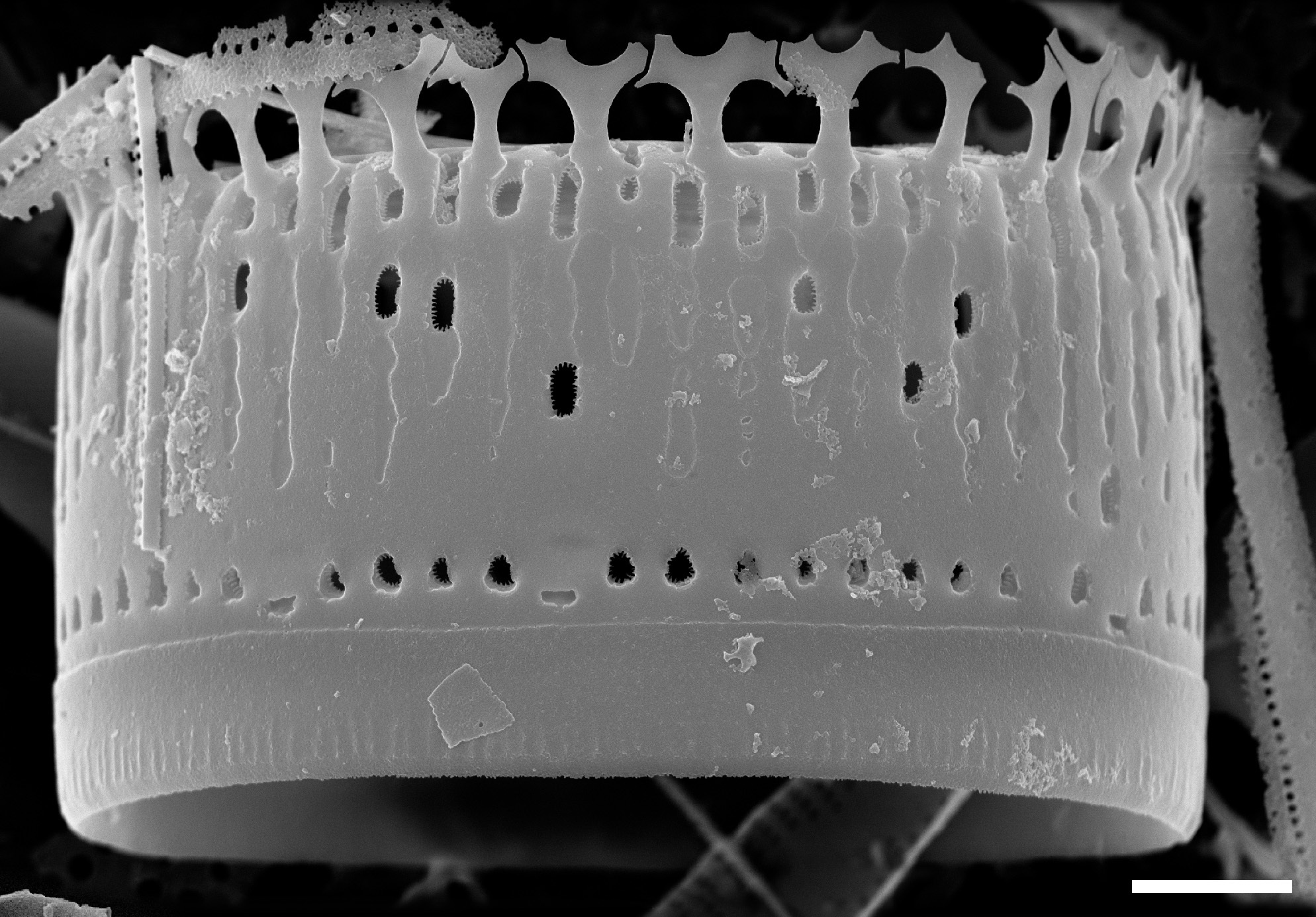 Aulacoseira newjerseyana SEM1