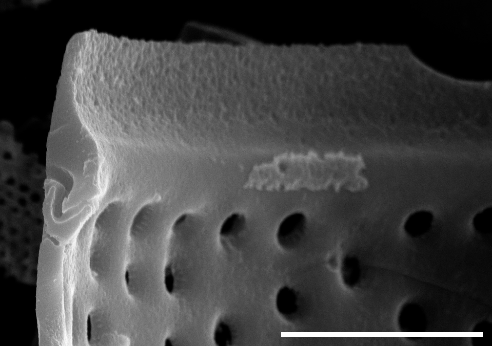 Aulacoseira newjerseyana SEM3