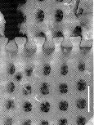 Aulacoseira canadensis SEM1