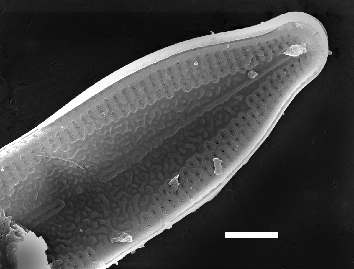 Nupela pennsylvanica SEM2