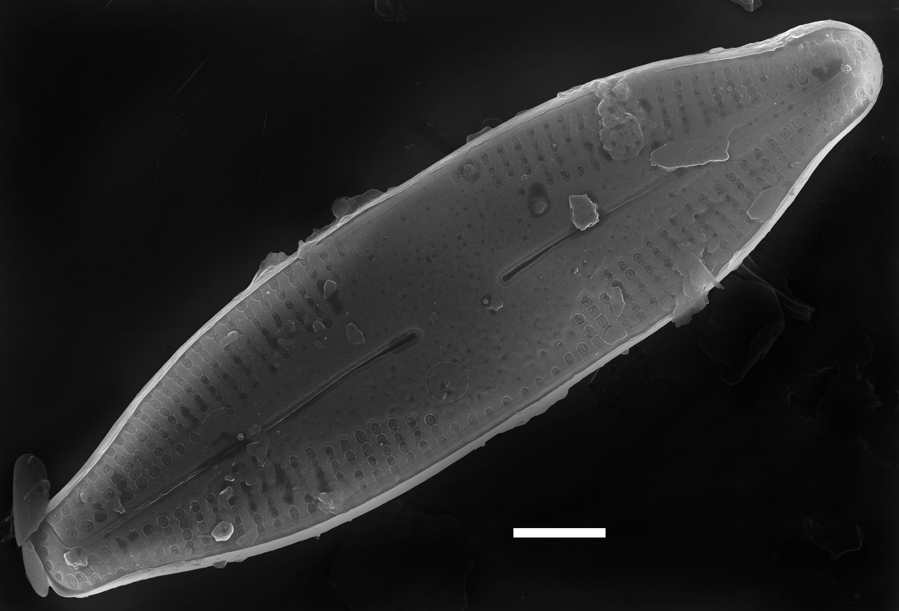 Nupela pennsylvanica SEM4