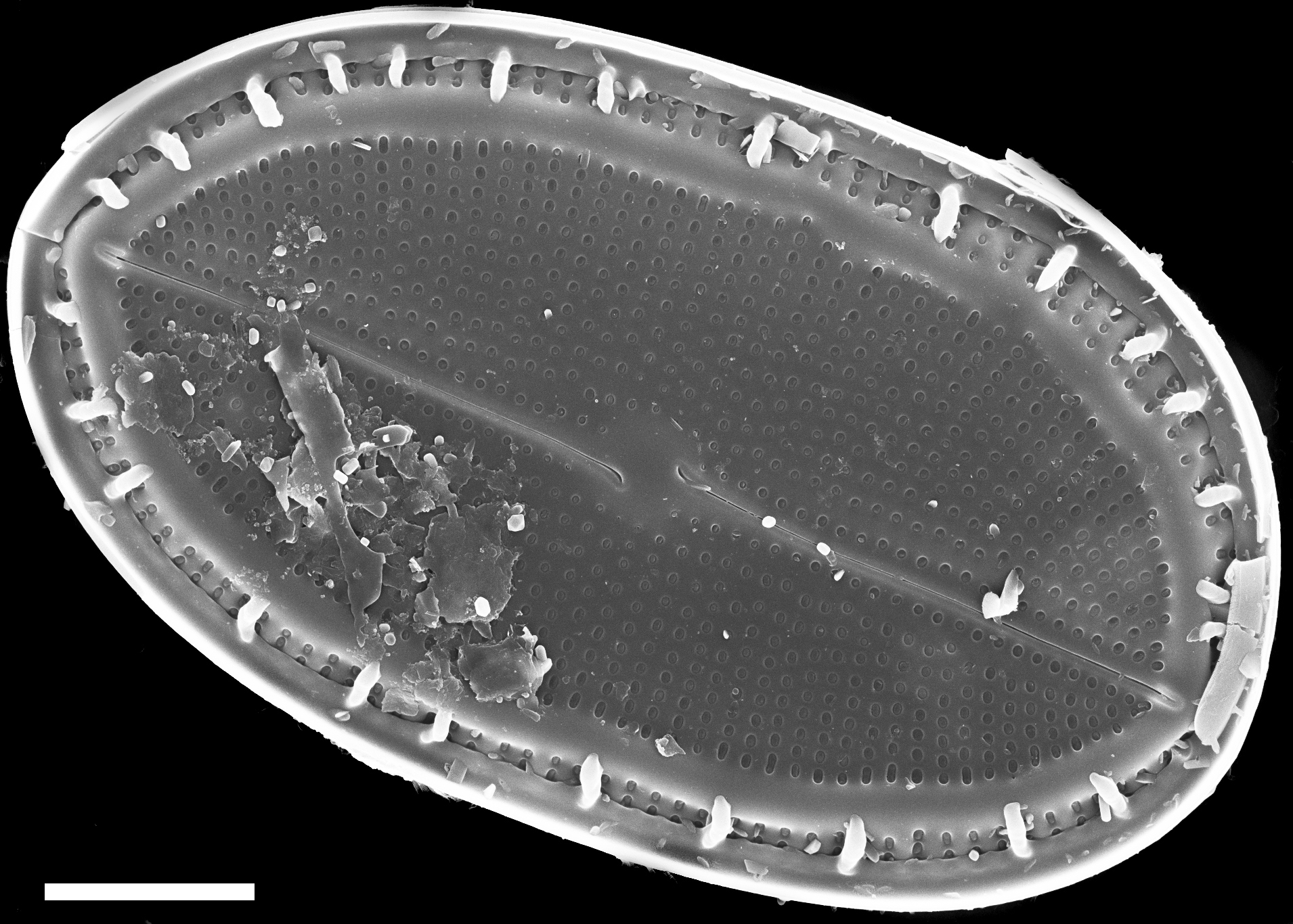 Cocconeis placentula SEM1