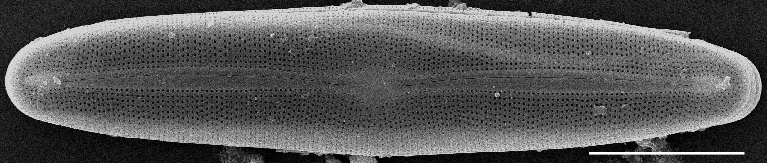 Frustulia asiatica SEM1