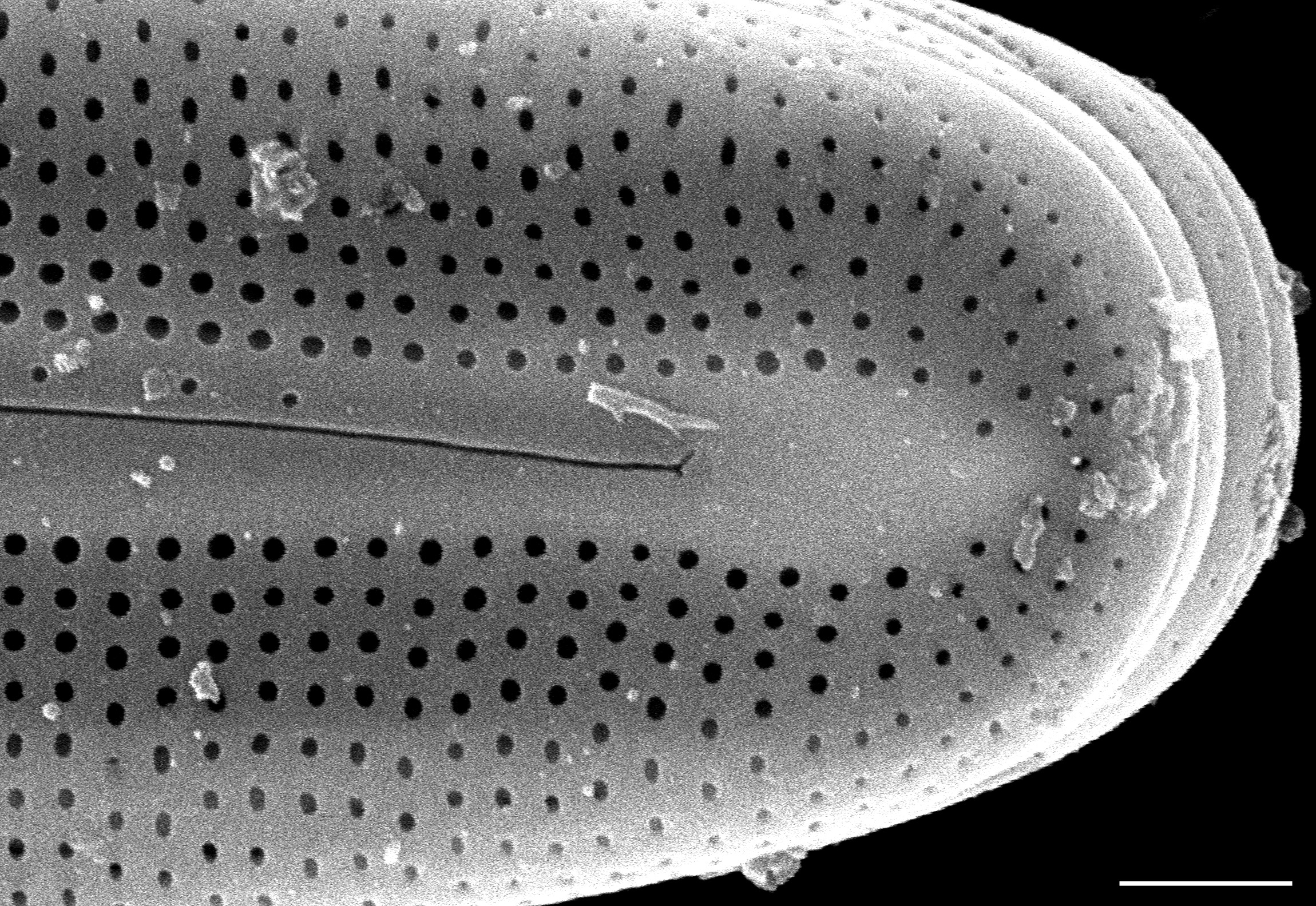 Frustulia asiatica SEM3