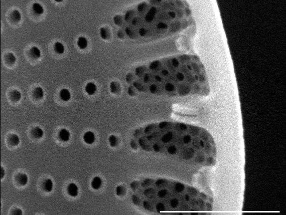 Cyclostephanos dubius SEM2