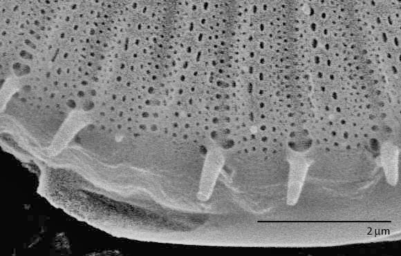 Cyclotella meneghiniana SEM1