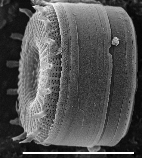 Discostella asterocostata SEM2