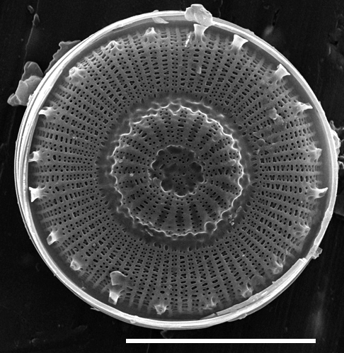 Discostella asterocostata SEM3 copy