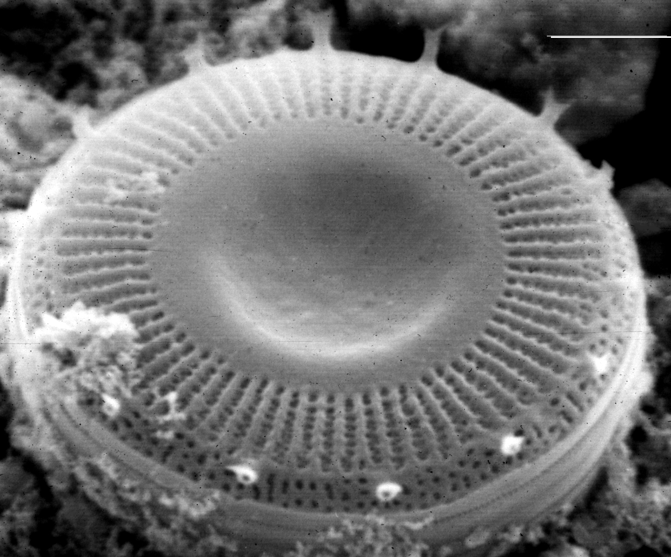 Discostella pseudostelligera  SEM1