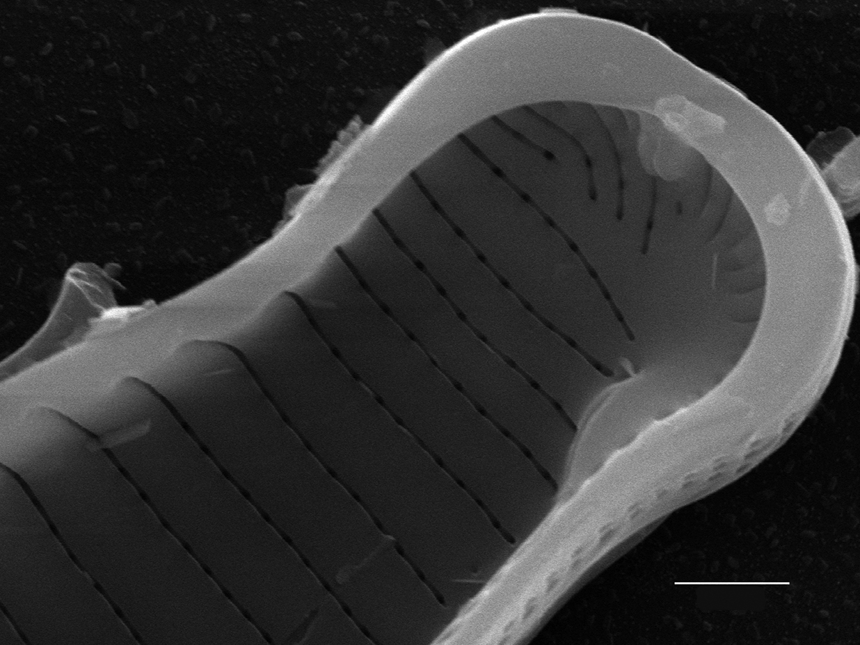 Eunotia kociolekii SEM1