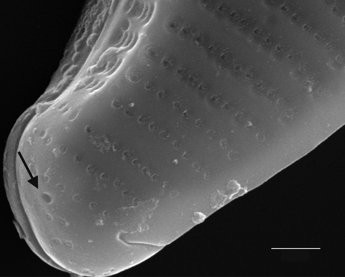 Eunotia kociolekii SEM2