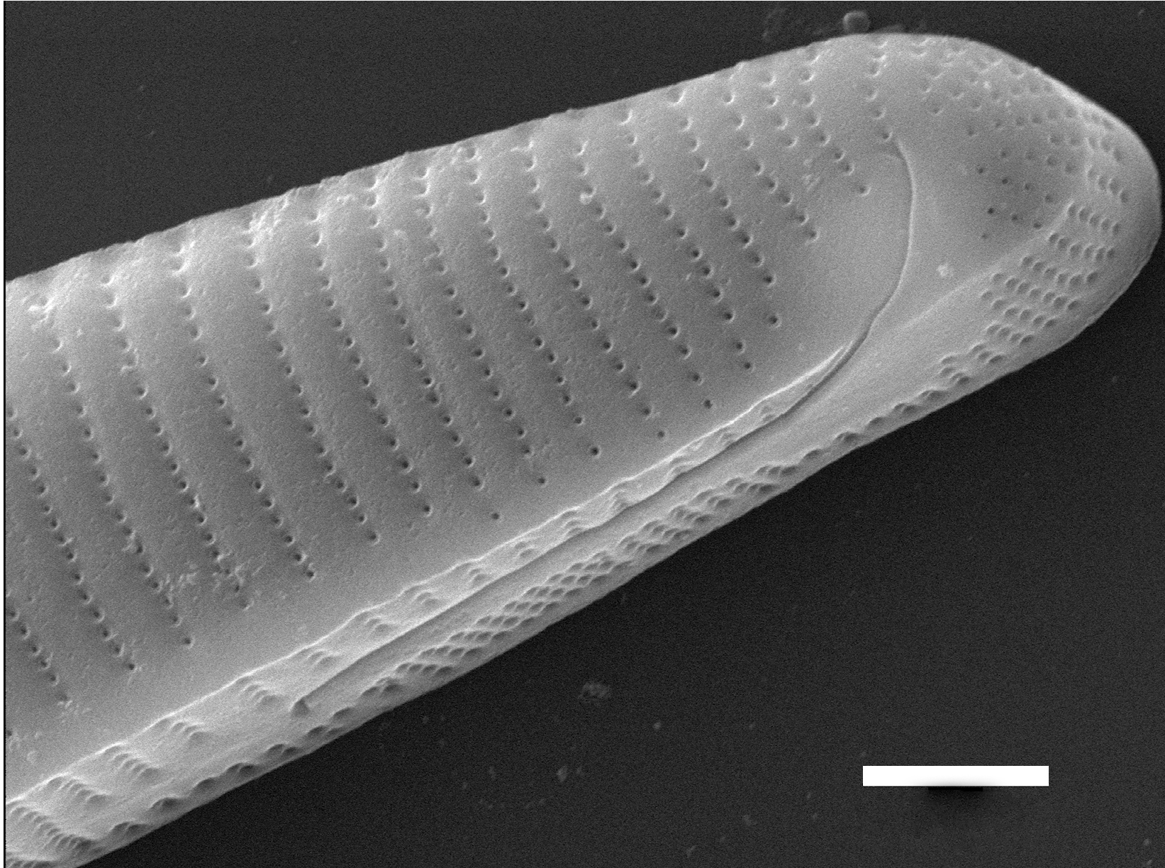 Eunotia macroglossa SEM2