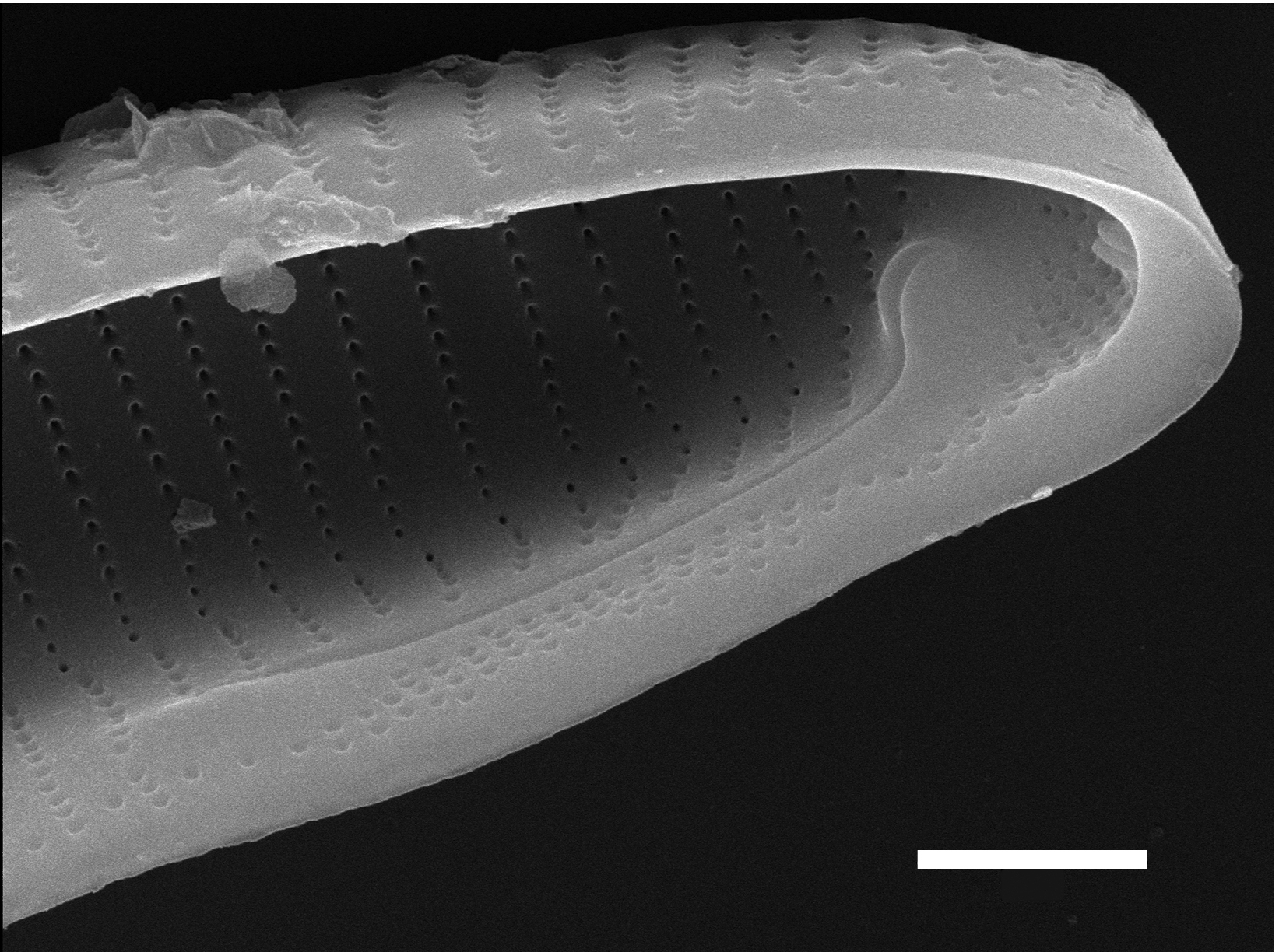 Eunotia macroglossa SEM5