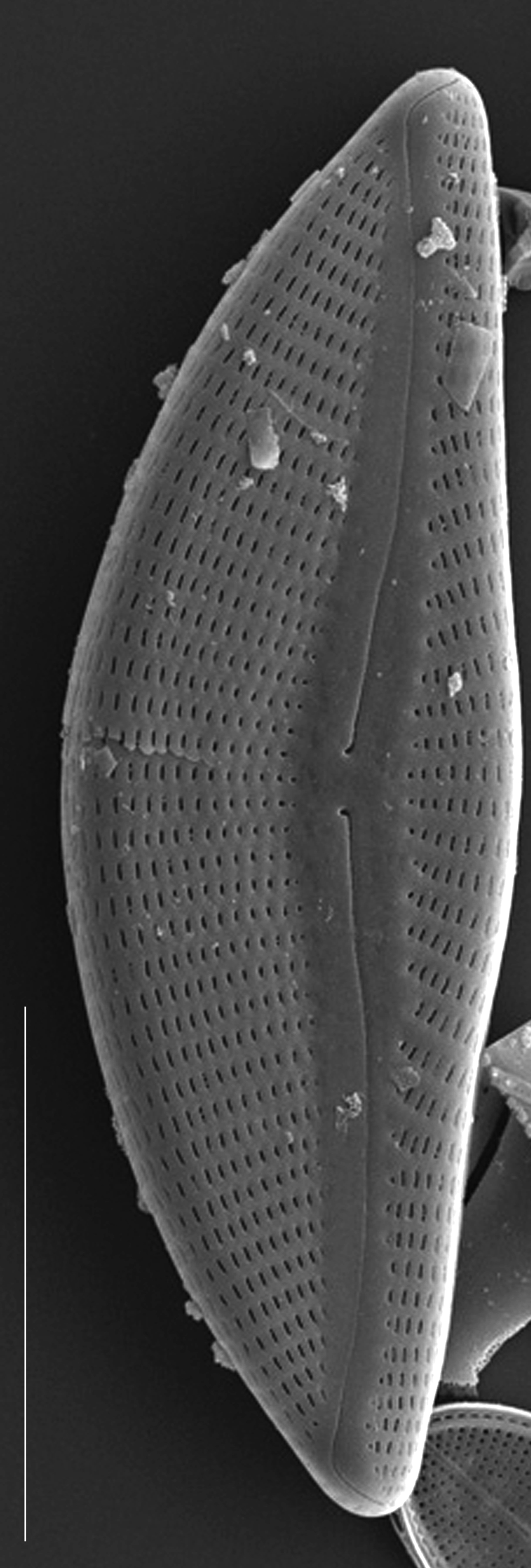 Encyonema yellowstonianum SEM1