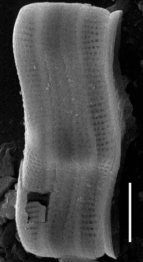 Achnanthes inflata SEM1