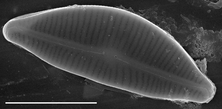 Encyonema hamsherae SEM3