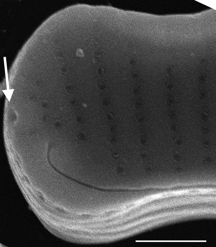 Eunotia cataractarum SEM3