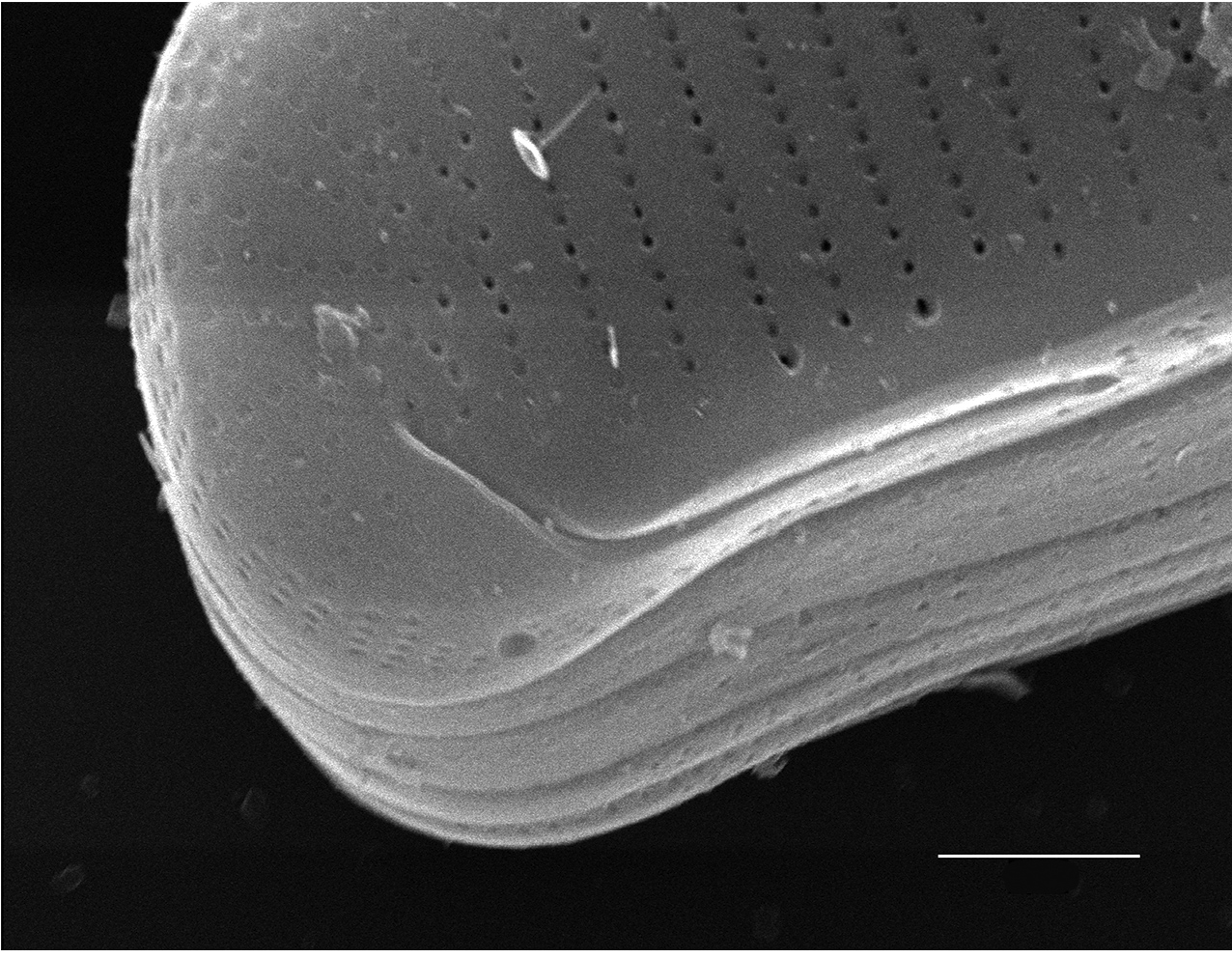 Eunotia richbuttensis SEM1