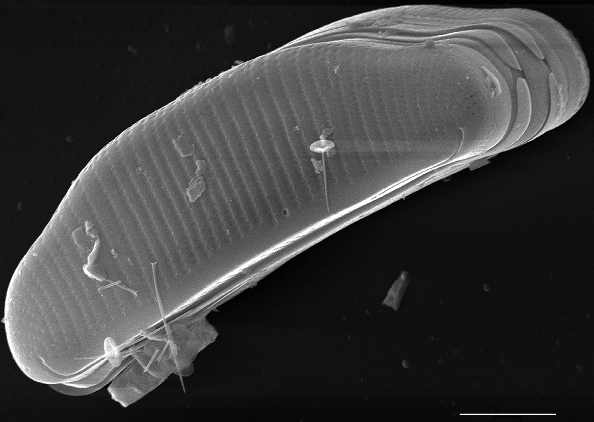 Eunotia richbuttensis SEM4