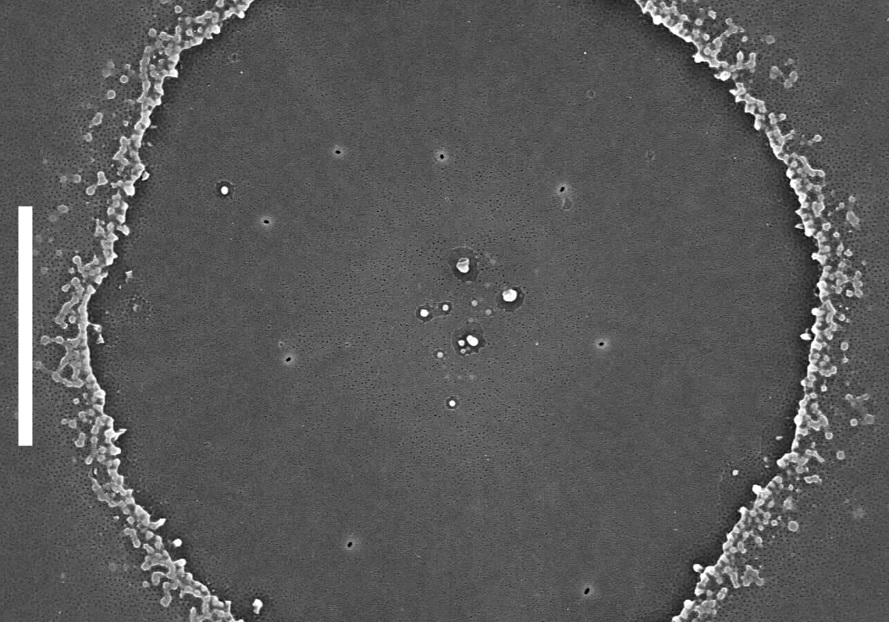 Melosira undulata SEM3