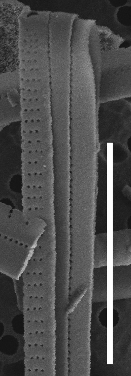 Fragilaria synegrotesca SEM1