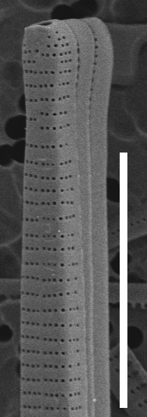 Fragilaria synegrotesca SEM2